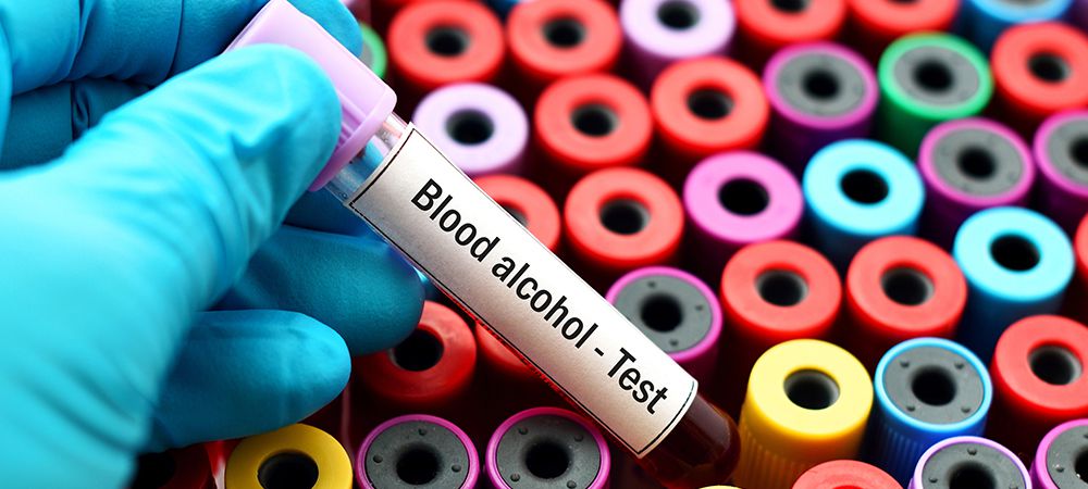 blood alcohol concentration