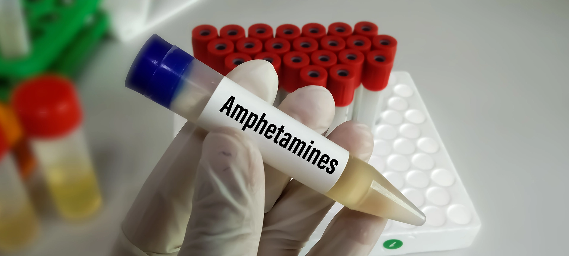 the amphetamine addictions