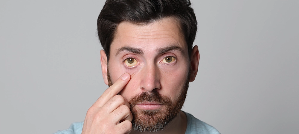 yellow eyes lung disease